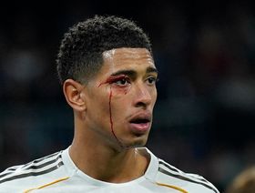 ريال مدريد "المُفلس" يخسر بـ9 لاعبين أمام سيلتا فيغو