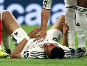 هل تعمّدت رابطة الدوري الإسباني إخفاء دماء كيليان مبابي؟