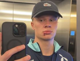 3 غرز في وجه هالاند قبل مواجهة النرويج ومولدوفا