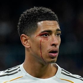 ريال مدريد "المُفلس" يخسر بـ9 لاعبين أمام سيلتا فيغو