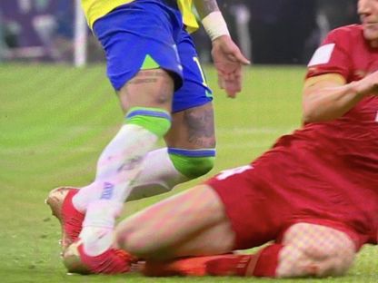 اصابة نيمار في مباراة البرازيل وصربيا بكأس العالم 2022 - TV/bein