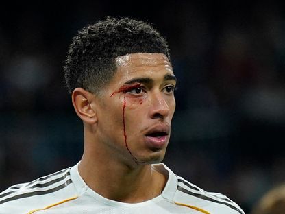 جود بيلينغهام لاعب ريال مدريد يتعرض لإصابة خلال مواجهة سيلتا فيغو في الدوري الإسباني - 7 ديسمبر 2025 - Reuters