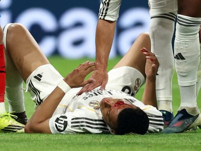 كيليان مبابي مهاجم ريال مدريد يتعرض لإصابة أمام جيرونا بالدوري الإسباني - 10 أبريل 2026 - Reuters