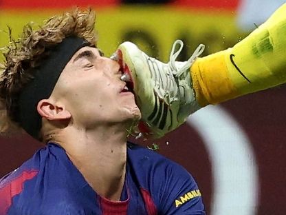 فيرمين لوبيز لحظة إصابته في الوجه بقدم الحارس خوان موسو في مباراة أتلتيكو مدريد وبرشلونة بدوري أبطال أوروبا - 14 أبريل 2026 - Reuters