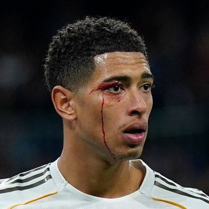 ريال مدريد "المُفلس" يخسر بـ9 لاعبين أمام سيلتا فيغو