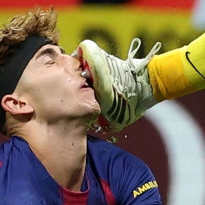 فيرمين لوبيز خضع لجراحة مؤلمة أثناء مواجهة أتلتيكو