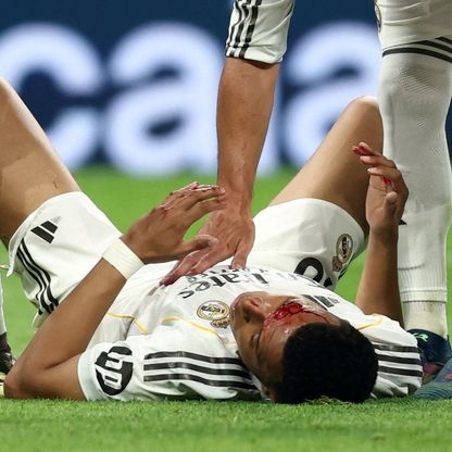 هل تعمّدت رابطة الدوري الإسباني إخفاء دماء كيليان مبابي؟