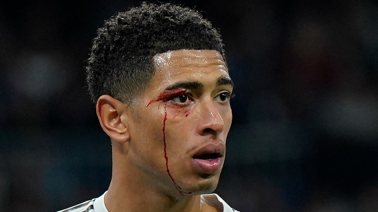 ريال مدريد "المُفلس" يخسر بـ9 لاعبين أمام سيلتا فيغو 