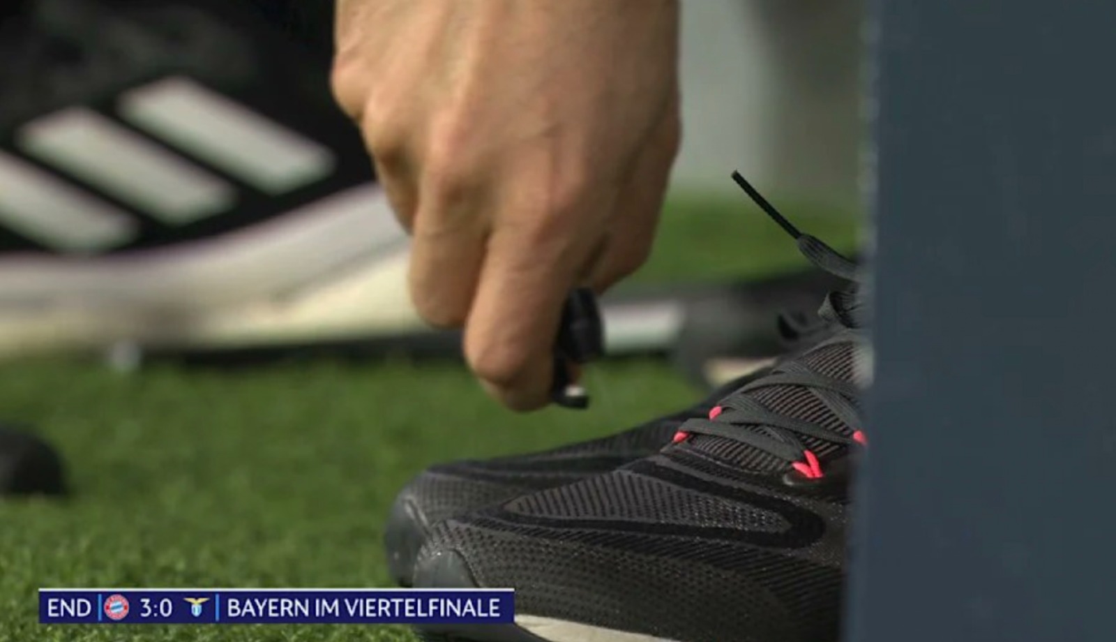 توماس توخيل يستخدم مخدر موضعي بعد إصابة إصبعه في مباراة بايرن ميونيخ ولاتسيو