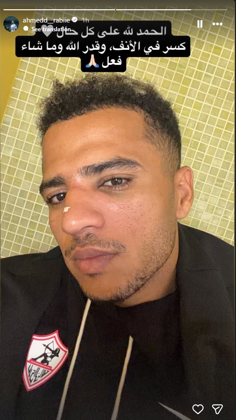 أحمد ربيع لاعب الزمالك يكشف عن كسر في الأنف – 18 أكتوبر 2026